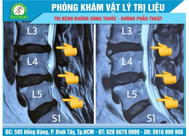 HIỂU ĐÚNG để điều trị ĐÚNG  